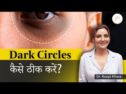 Dark Circles के लिए Best treatment | Dermal Fillers Treatment in Ludhiana | Dr. Roopi Kheera
